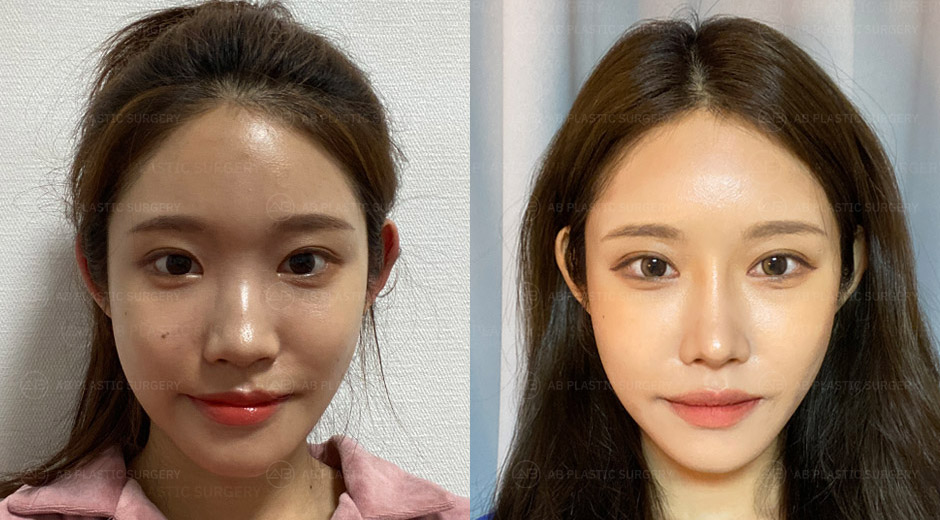AB Plastic Surgery